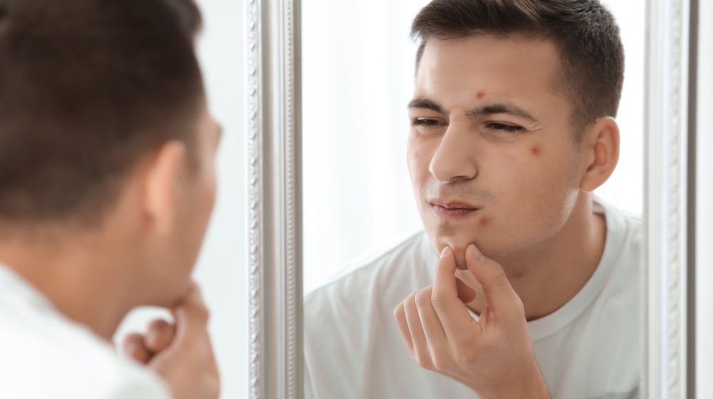 portrait-young-man-acne-problem-looking | Inflammation In the Body & How It Ages You | featured