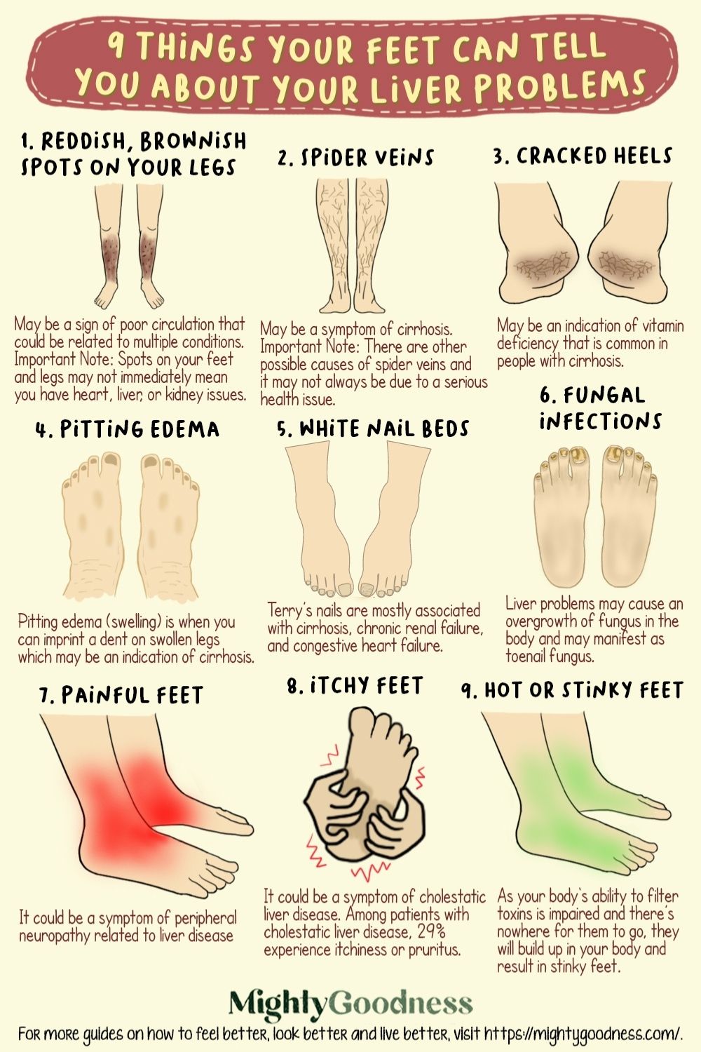 9 Things Your Feet Can Tell You About Your Liver Problems