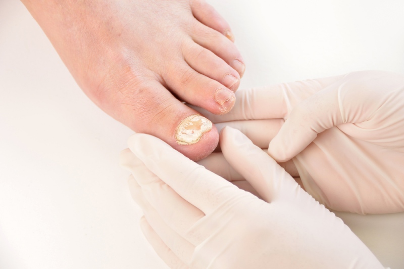 closeup image podologist checking left foot | sign of liver problems