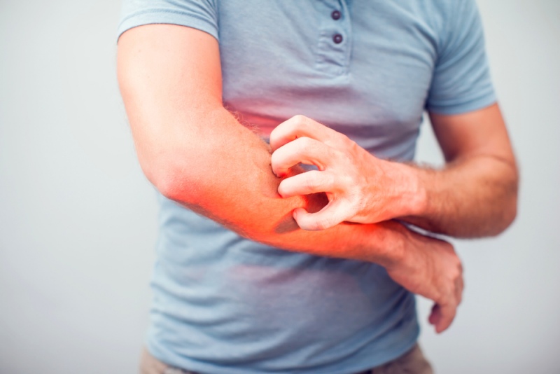 people scratch itch hand elbow itching | how do you know if you have kidney problems