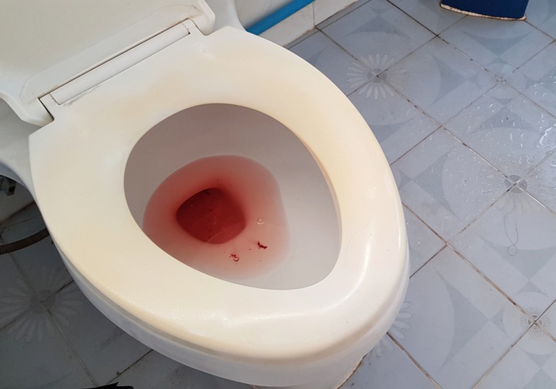 Red Tinge Urine | Pee Color Meaning | Urine Wheel Chart |Urine is red blood urine in flush tank in the bathroom, pee mix bloody
