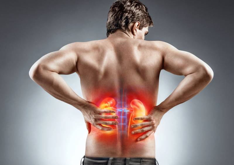 kidneys-pain-man-holding-his-back | kidney stones
