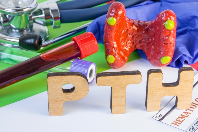 Medical Laboratory Abbreviation PTH Parathyroid Hormone | Hyperparathyroid Symptoms