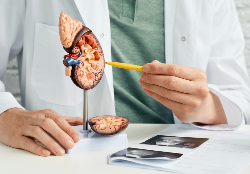 urology treatment kidney disease doctor analyzing | How to Improve Kidney Function in Elderly