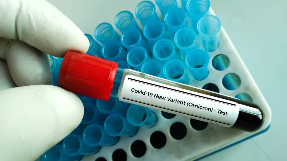 Researcher hold blood sample for New Variant of the Covid-19 Omicron B.1.1.529 test | First COVID Omicron Case Detected In the United States | featured