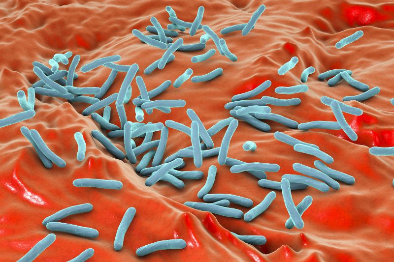 3D Illustration Bacterium Mycobacterium Tuberculosis | Lupus Pernio