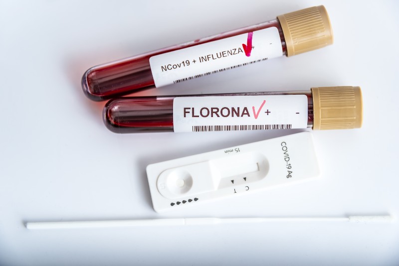 Blood samples of new variant OMICRON plus flu FLORONA | Flurona