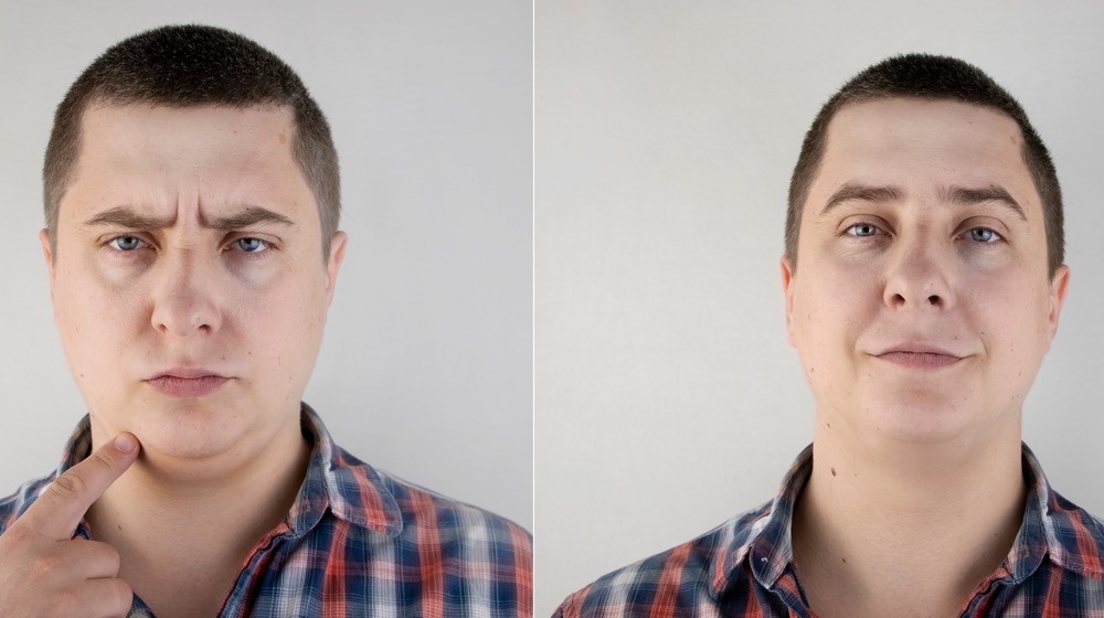 The man has a double chin. Photos before and after | Close-up of a patient's sad face and his fat on his neck | carb face vs keto face | what happens if you eat too much carbohydrates