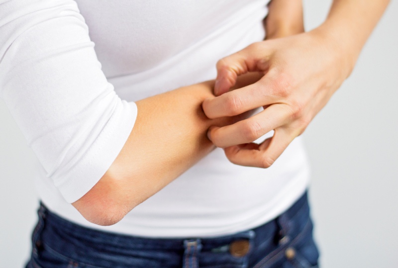 woman scratching her arm | diabetes symptoms
