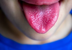 Tongue Color | 7 Scary Tongue Color Meanings - Mighty Goodness