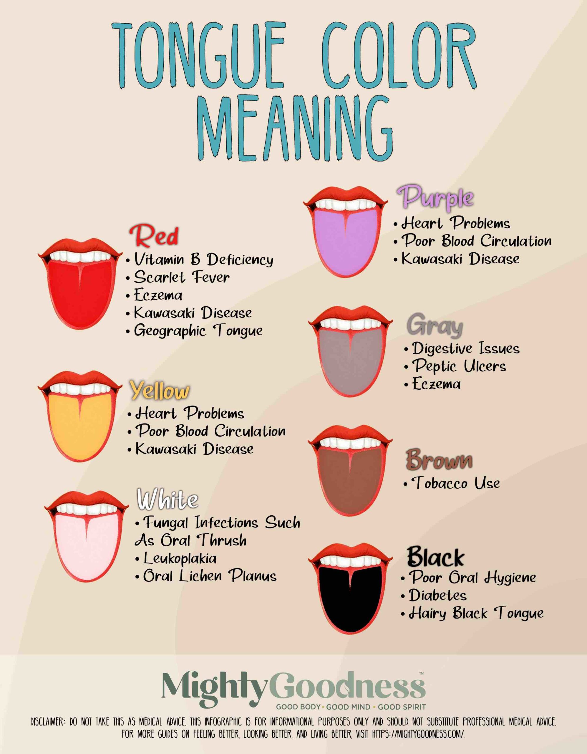 Tongue Color Chart | Tongue Color Meaning | what do different tongue colors mean | unhealthy healthy tongue color